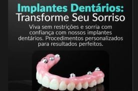 Protese Protocolo-Carga Imediata Campinas