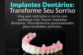 Protese Protocolo-Carga Imediata Campinas